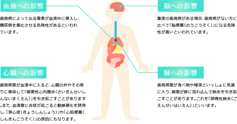 歯周病とからだとの関わり