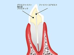 ファイバーコア