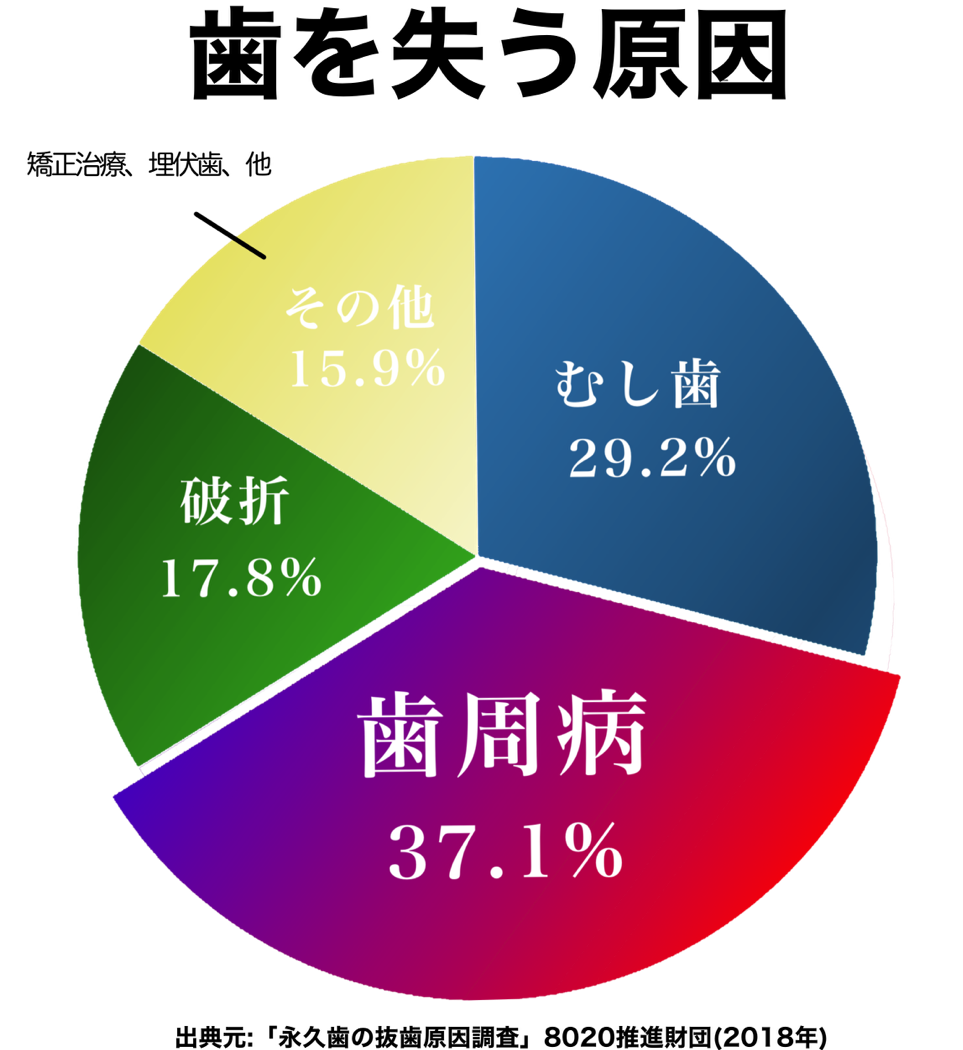 歯を失う原因の第1位の「歯周病」とは