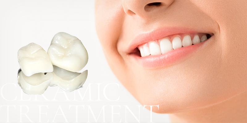 CERAMIC TREATMENT