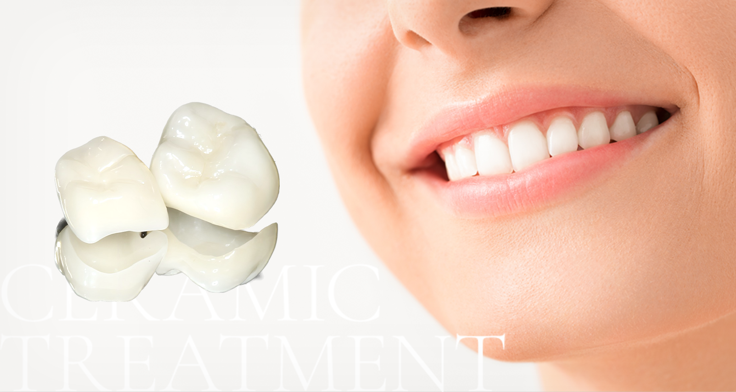 CERAMIC TREATMENT